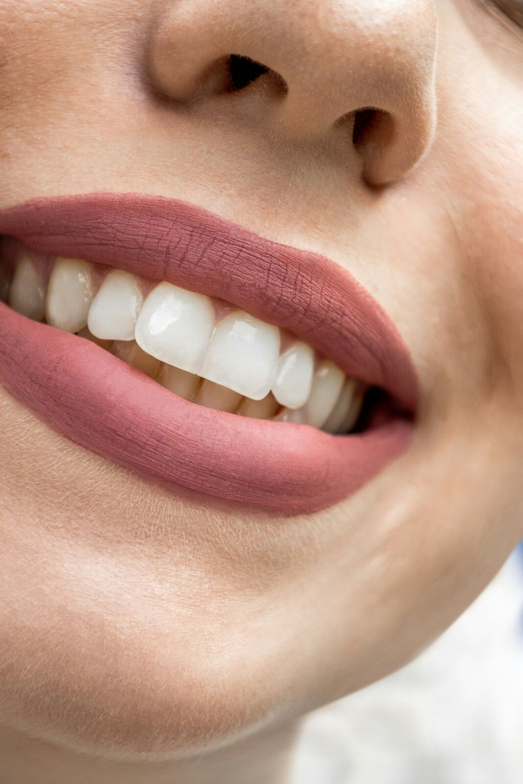 Teeth Whitening & Smile Care
